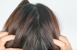 Read more about the article Hair Density