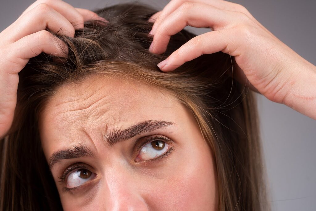 A woman experiencing women's hair loss.