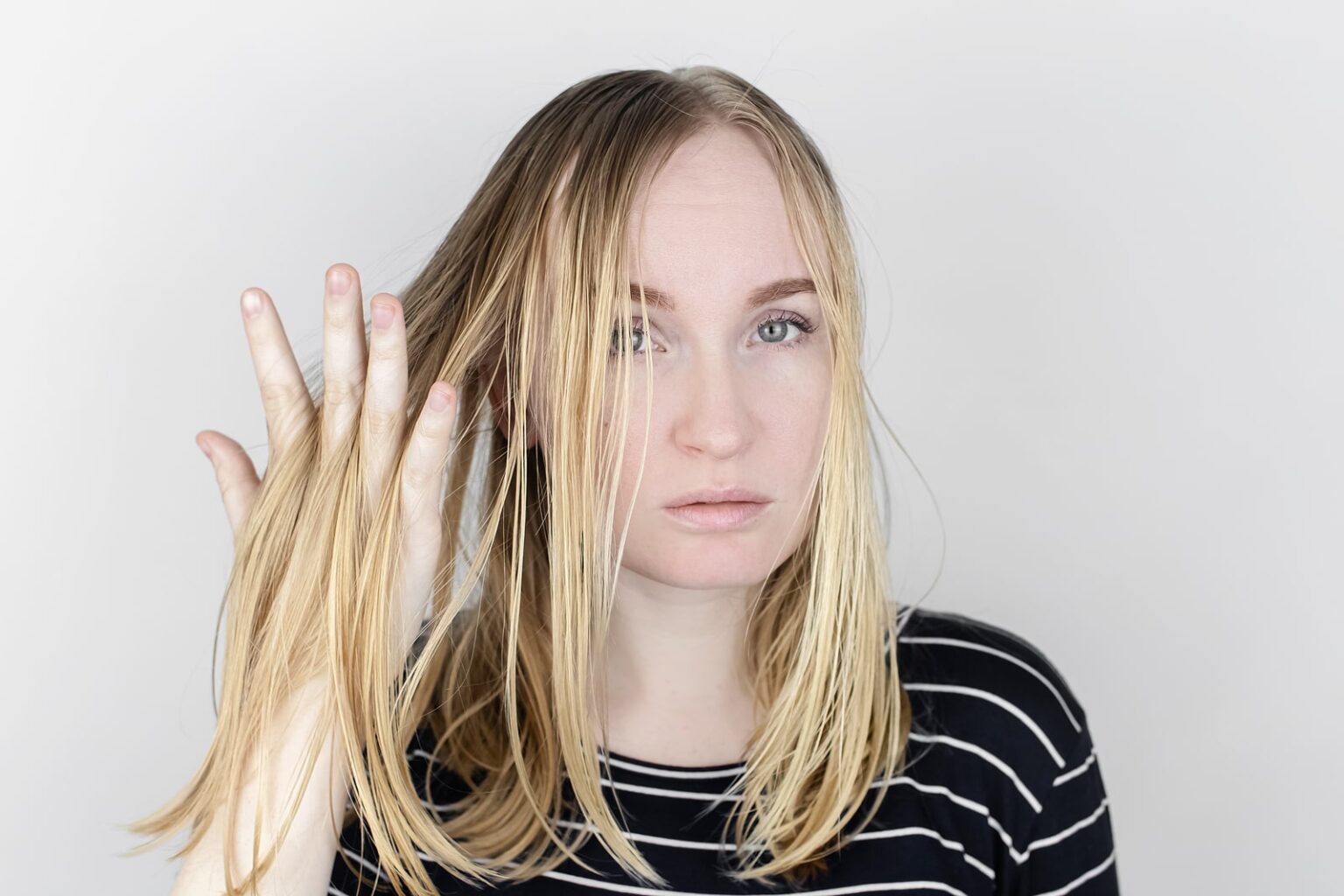 Oily Hair: Causes and Solutions | Eldorado Hair Restoration