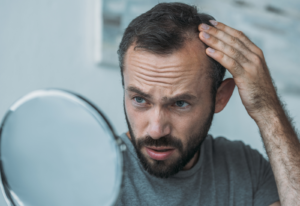 Image of a man looking at his hairline in a mirror