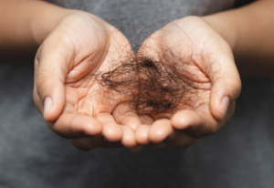 Read more about the article Trichotillomania: Understanding and Coping with Hair-Pulling Disorder