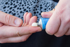 Image of a person squeezing acne medication from a tube