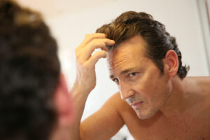 Read more about the article Coping with Hair Loss Due to Chronic Illness