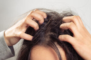 Image of a person scratching their scalp